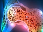 Οστεοπόρωση: τα προβιοτικά επιβραδύνουν την οστική απώλεια