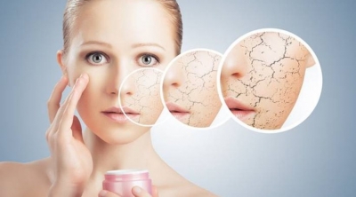 10 τρόποι να καταπολεμήσουμε το ξηρό δέρμα